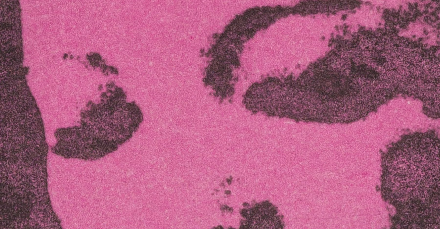 A pink graphic of a close up of a person’s face, with the main features in view being the eyes and nose.